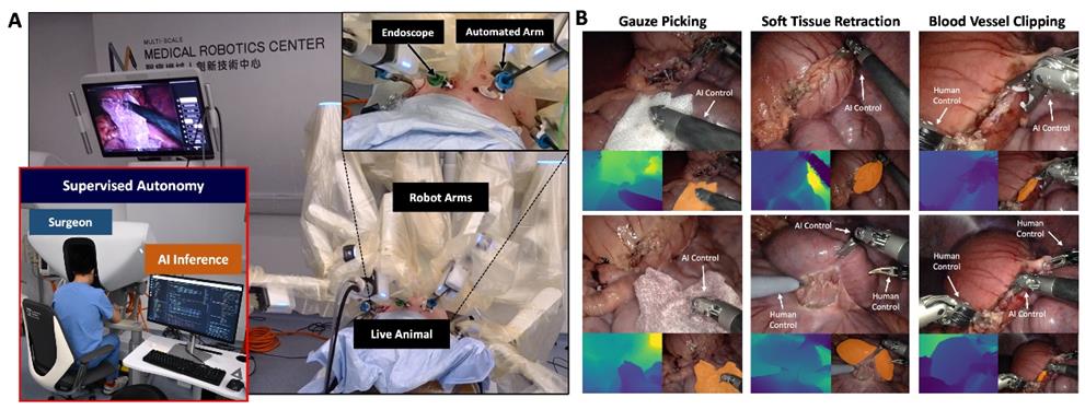 20250806krsten3 Cornerstone Robotics Completes World's First Clinical Validation of Autonomous Surgery Performed by Robot-Assisted Surgery